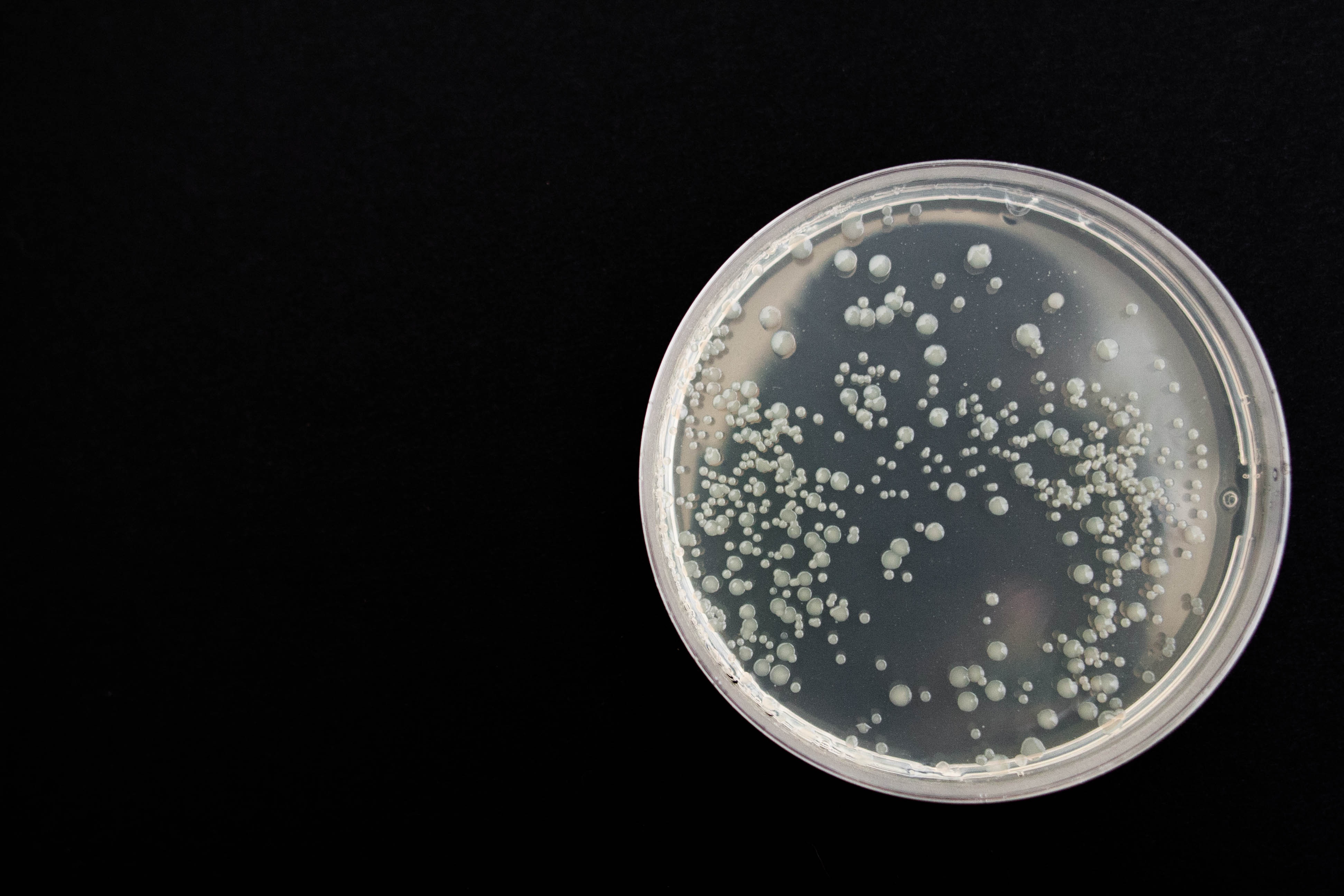 bacterial colonies on petri plate