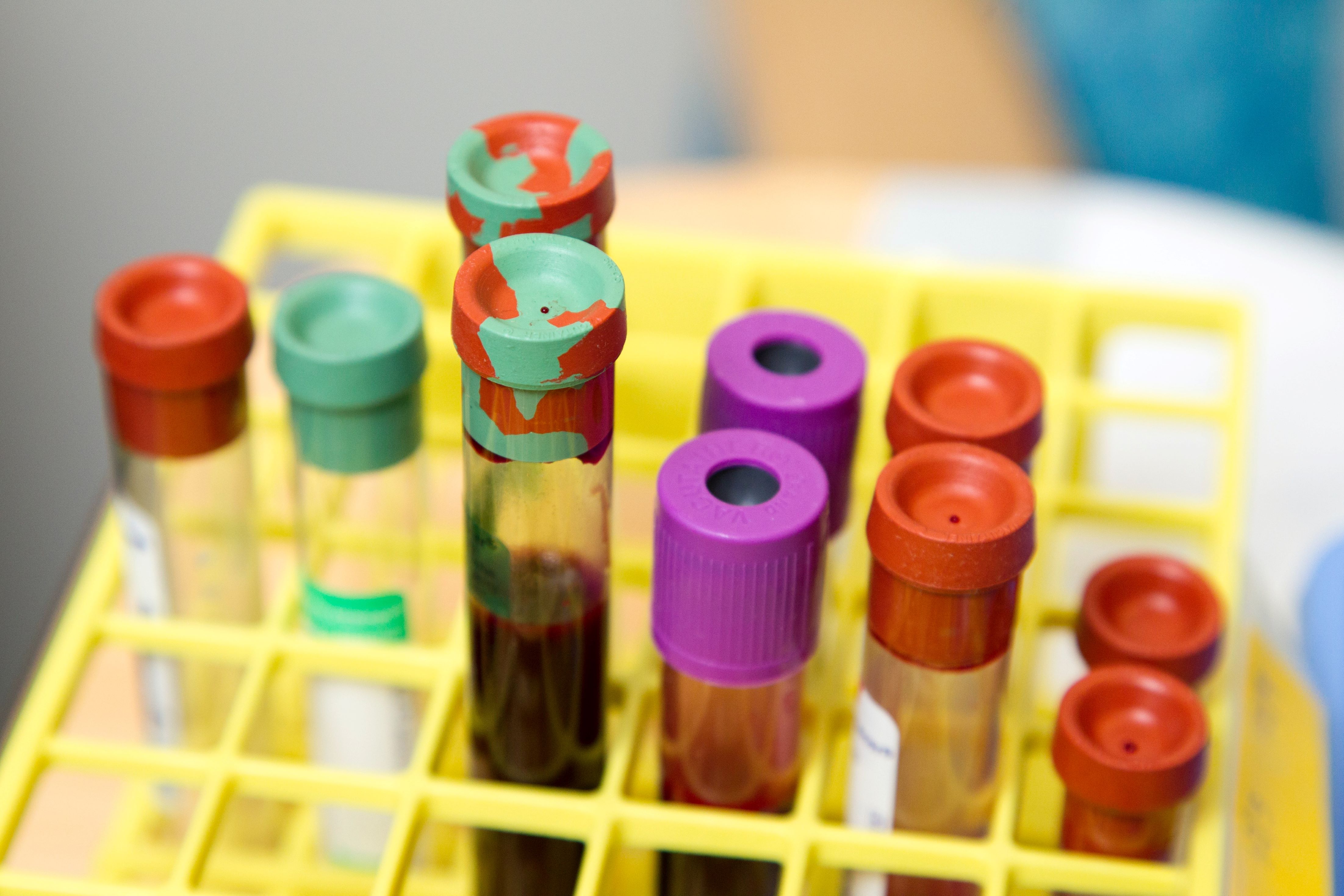 test tube rack with blood collection tubes